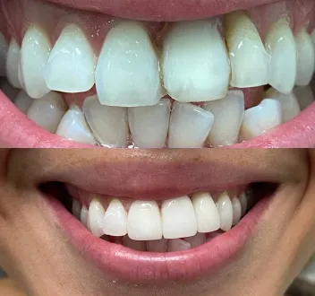 smile-gallery gallery