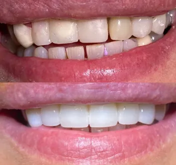smile-gallery gallery