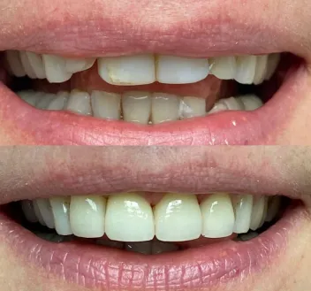 smile-gallery gallery