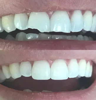 smile-gallery gallery