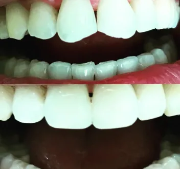 smile-gallery gallery